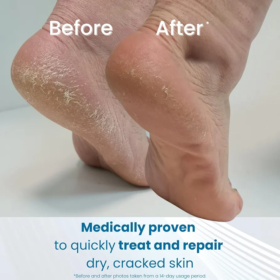 Flexitol Cracked Heel Balm - Image 3